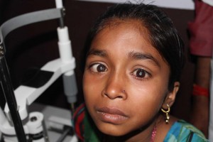 An young Indian girl with severe cataract problems